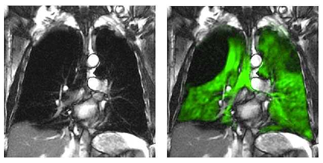 Lung images