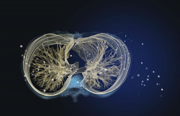 TeraRecon lung image