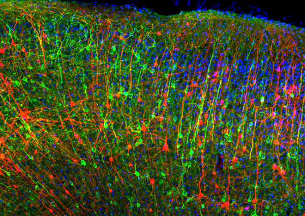 Image of protein labeling in mouse brain
